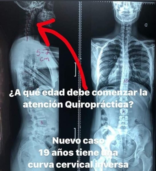 Quiropraxia Rebot