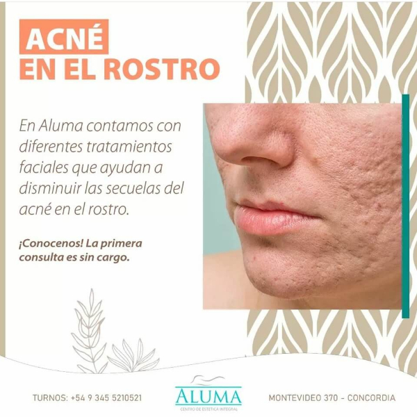 Aluma Cetro de Estética Integral